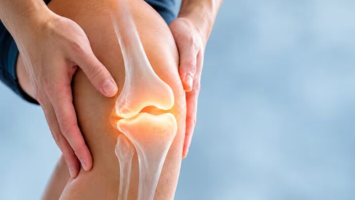 osteoartritis